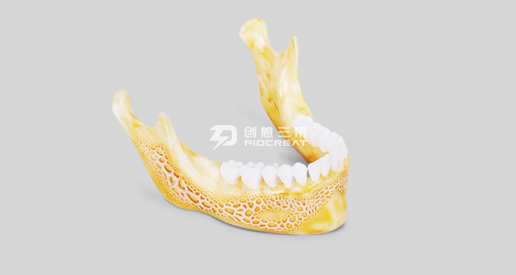 南宫28官方-齿科3D打印机在齿科领域的应用